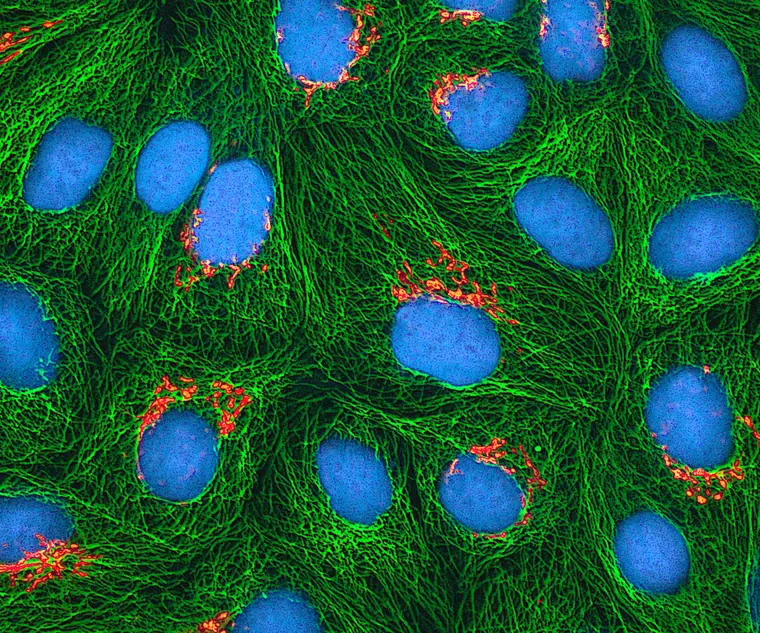 Multiphoton fluorescence micrograph of cultured HeLa cells, with the Golgi apparatus in orange, microtubules in green and cell nuclei in cyan.