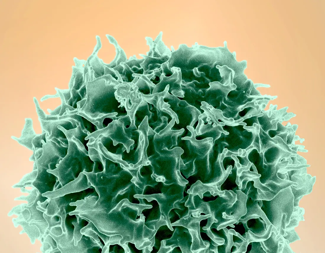 Colorized scanning electron micrograph of a single healthy human T lymphocyte, shown in green with a deeply folded surface.