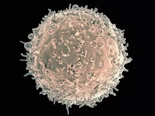 Colorized scanning electron micrograph of a human B cell, its surface covered in fine folds.